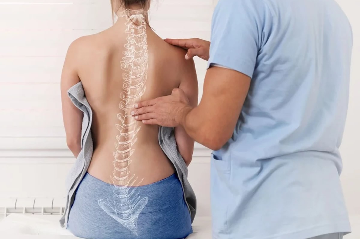 escoliosis